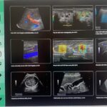 Νέος υπερηχοτομογράφος GE HealthCare LOGIQ E10s στο Γενικό Νοσοκομείο Χανίων (φώτο)
